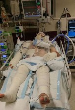 Stuart Pollard in intensive care after the explosion